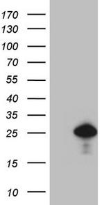CDKN1A Antibody in Western Blot (WB)