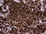 CEA (CEACAM5) Antibody in Immunohistochemistry (Paraffin) (IHC (P))