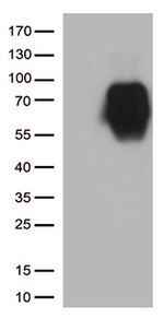 B7-2 (CD86) Antibody in Western Blot (WB)
