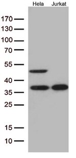 Caspase 3 (CASP3) Antibody in Western Blot (WB)