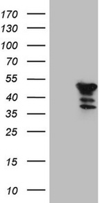 CIAPIN1 Antibody in Western Blot (WB)