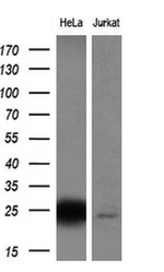 CITED1 Antibody in Western Blot (WB)