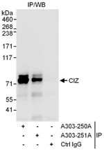 CIZ Antibody in Immunoprecipitation (IP)