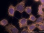 Beta-2-Microglobulin Antibody in Immunocytochemistry (ICC/IF)