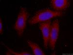SMN-Exon7 Antibody in Immunocytochemistry (ICC/IF)