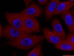ZC3HAV1 Antibody in Immunocytochemistry (ICC/IF)
