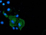 CORO1A Antibody in Immunocytochemistry (ICC/IF)