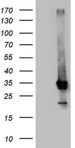 CRP Antibody in Western Blot (WB)