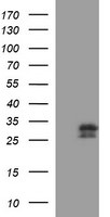CSH1 Antibody in Western Blot (WB)