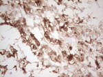 CSNK1G1 Antibody in Immunohistochemistry (Paraffin) (IHC (P))