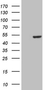 CSNK1G1 Antibody in Western Blot (WB)