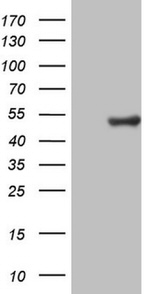 CSNK1G1 Antibody in Western Blot (WB)
