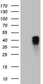 CTSL1 Antibody in Western Blot (WB)