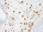 Coronin 1 Antibody in Immunohistochemistry (IHC)