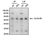 Cyclin B1 Antibody in Immunoprecipitation (IP)