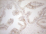 DECR1 Antibody in Immunohistochemistry (Paraffin) (IHC (P))