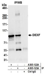 DIEXF/C1orf107 Antibody in Immunoprecipitation (IP)