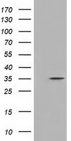 DNTTIP1 Antibody in Western Blot (WB)