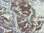 DOK7 Antibody in Immunohistochemistry (Paraffin) (IHC (P))