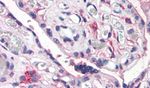 CD26 Antibody in Immunohistochemistry (Paraffin) (IHC (P))