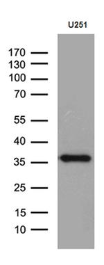 DTWD1 Antibody in Western Blot (WB)