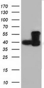DYNC1LI1 Antibody in Western Blot (WB)