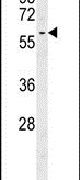 DYNC1LI2 Antibody in Western Blot (WB)