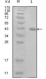 HPV Type 16 E7 Antibody in Western Blot (WB)