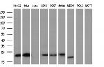 EFNA2 Antibody in Western Blot (WB)