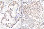 EFTUD2/SNRP116 Antibody in Immunohistochemistry (IHC)