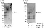 EPC1 Antibody in Western Blot (WB)