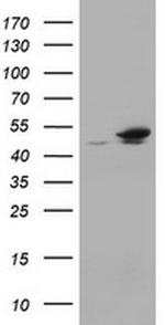 EPHX1 Antibody in Western Blot (WB)