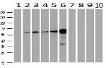 EPHX2 Antibody in Western Blot (WB)