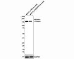 VEGFR1 Antibody in Immunohistochemistry (Paraffin) (IHC (P))