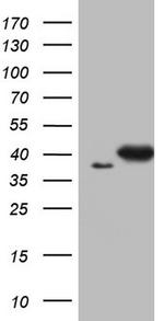 ERCC1 Antibody in Western Blot (WB)