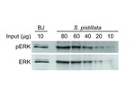 Phospho-ERK1/ERK2 (Tyr204) Antibody in Western Blot (WB)