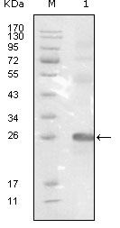 EphB3 Antibody in Western Blot (WB)