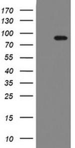 F13A1 Antibody in Western Blot (WB)