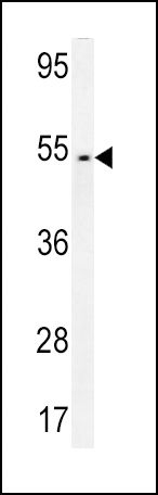 FAM46A Antibody in Western Blot (WB)
