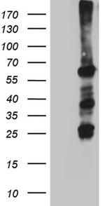 FANCC Antibody in Western Blot (WB)