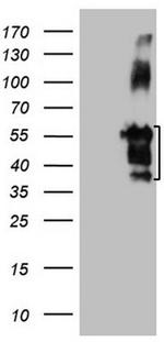 FBLIM1 Antibody in Western Blot (WB)