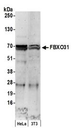 FBXO31 Antibody in Western Blot (WB)