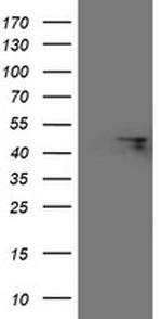 FBXO31 Antibody in Western Blot (WB)