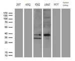FBXO6 Antibody in Western Blot (WB)