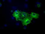 FERMT2 Antibody in Immunocytochemistry (ICC/IF)