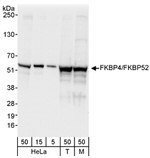 FKBP4/FKBP52 Antibody in Western Blot (WB)