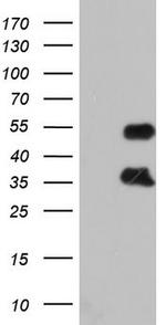 FOSB Antibody in Western Blot (WB)