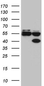 FOXR1 Antibody in Western Blot (WB)