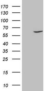 FSCN1 Antibody in Western Blot (WB)