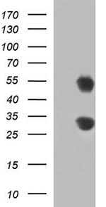 GADD45A Antibody in Western Blot (WB)